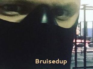 Bruisedup