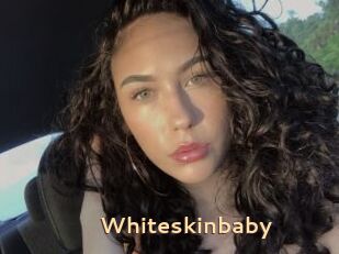 Whiteskinbaby