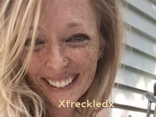 Xfreckledx